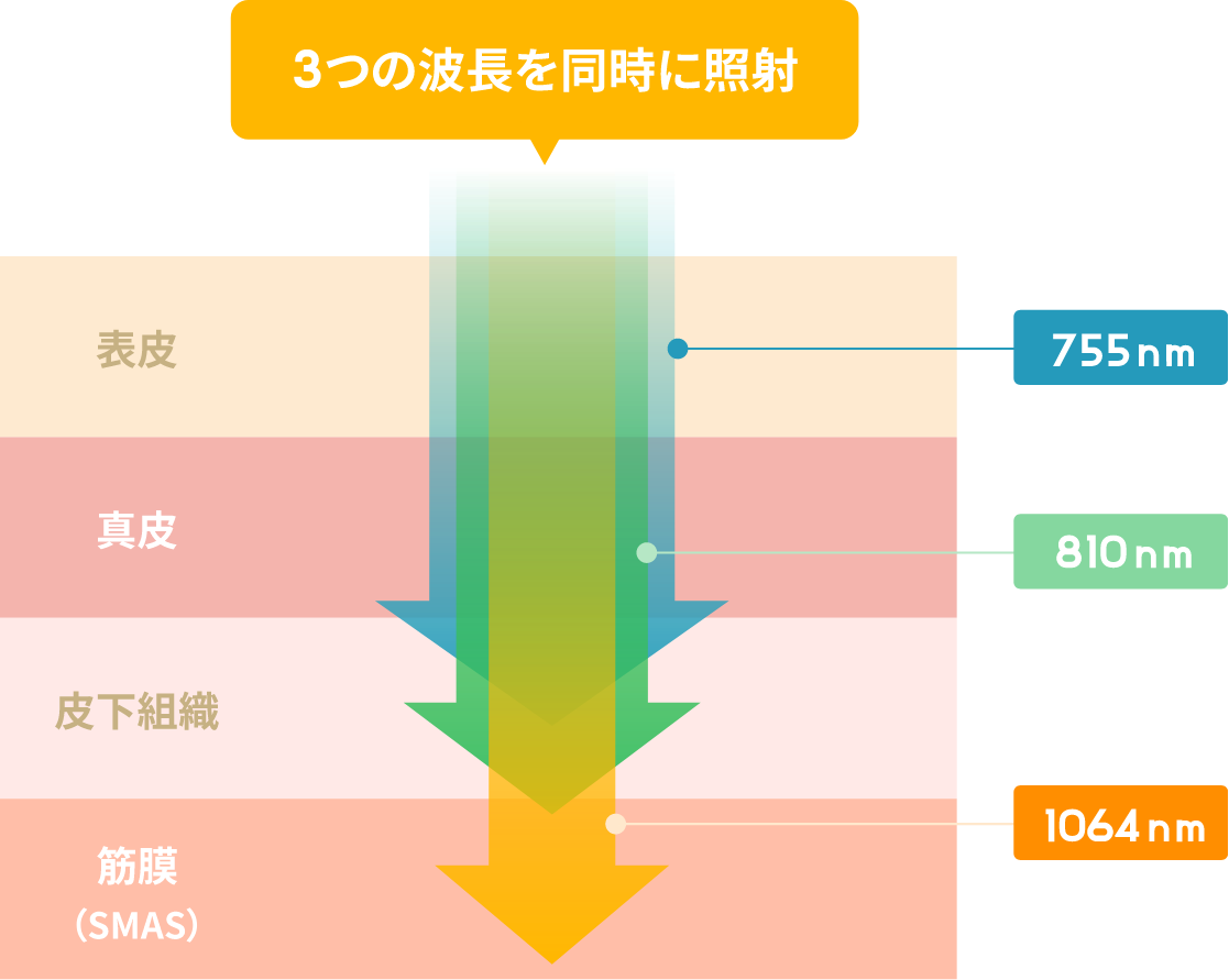 3つの波長を同時に照射